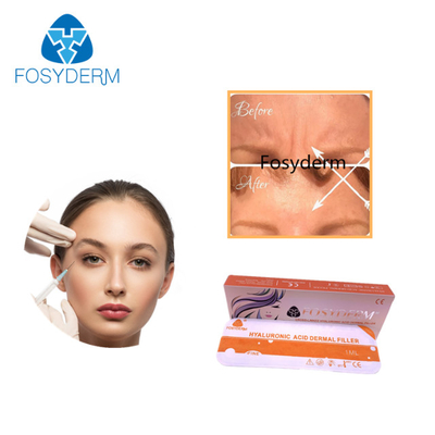 Texture douce de empaquetage MOQ 1Box de remplisseur facial d'acide hyaluronique de seringue